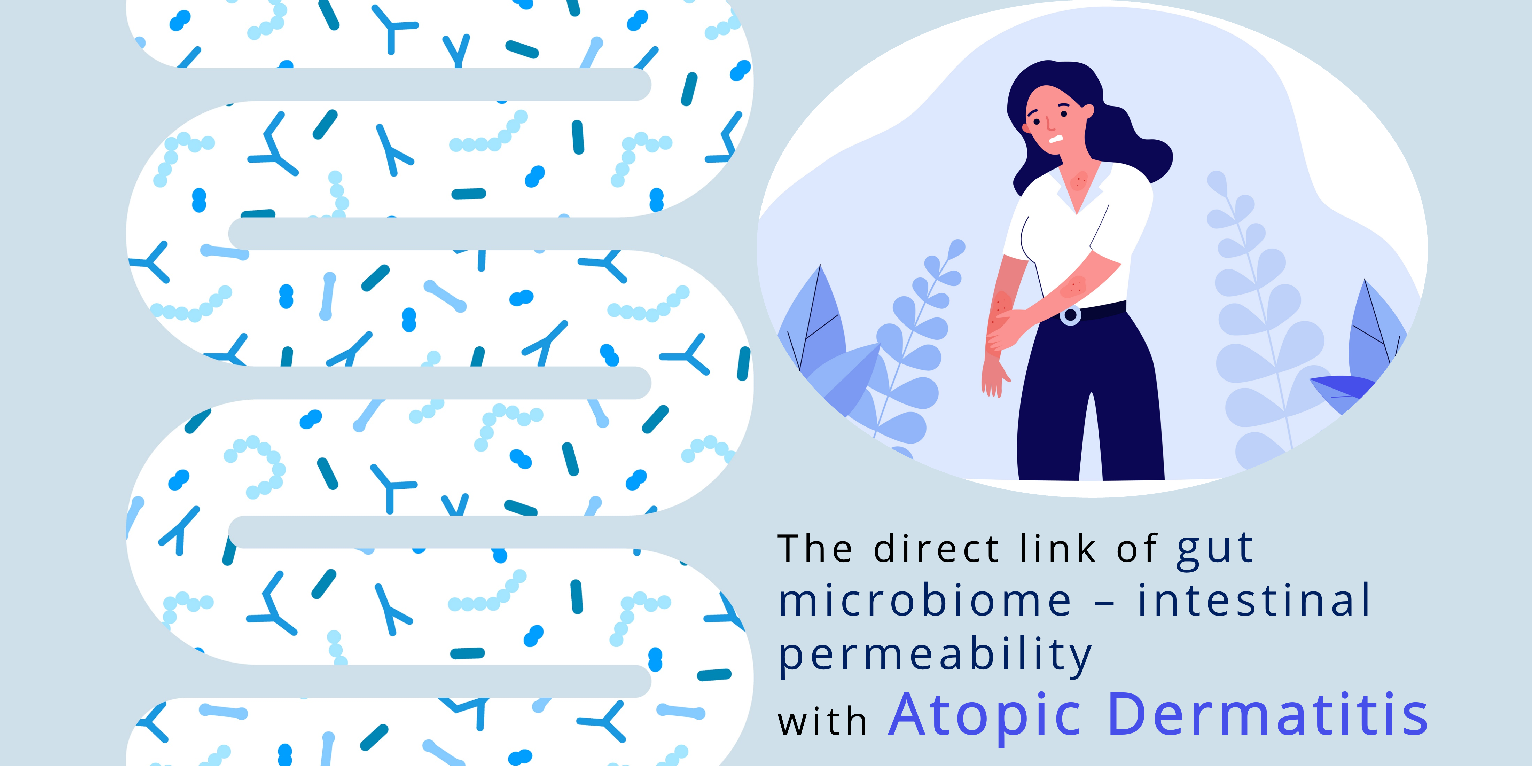 atopic dermatitis