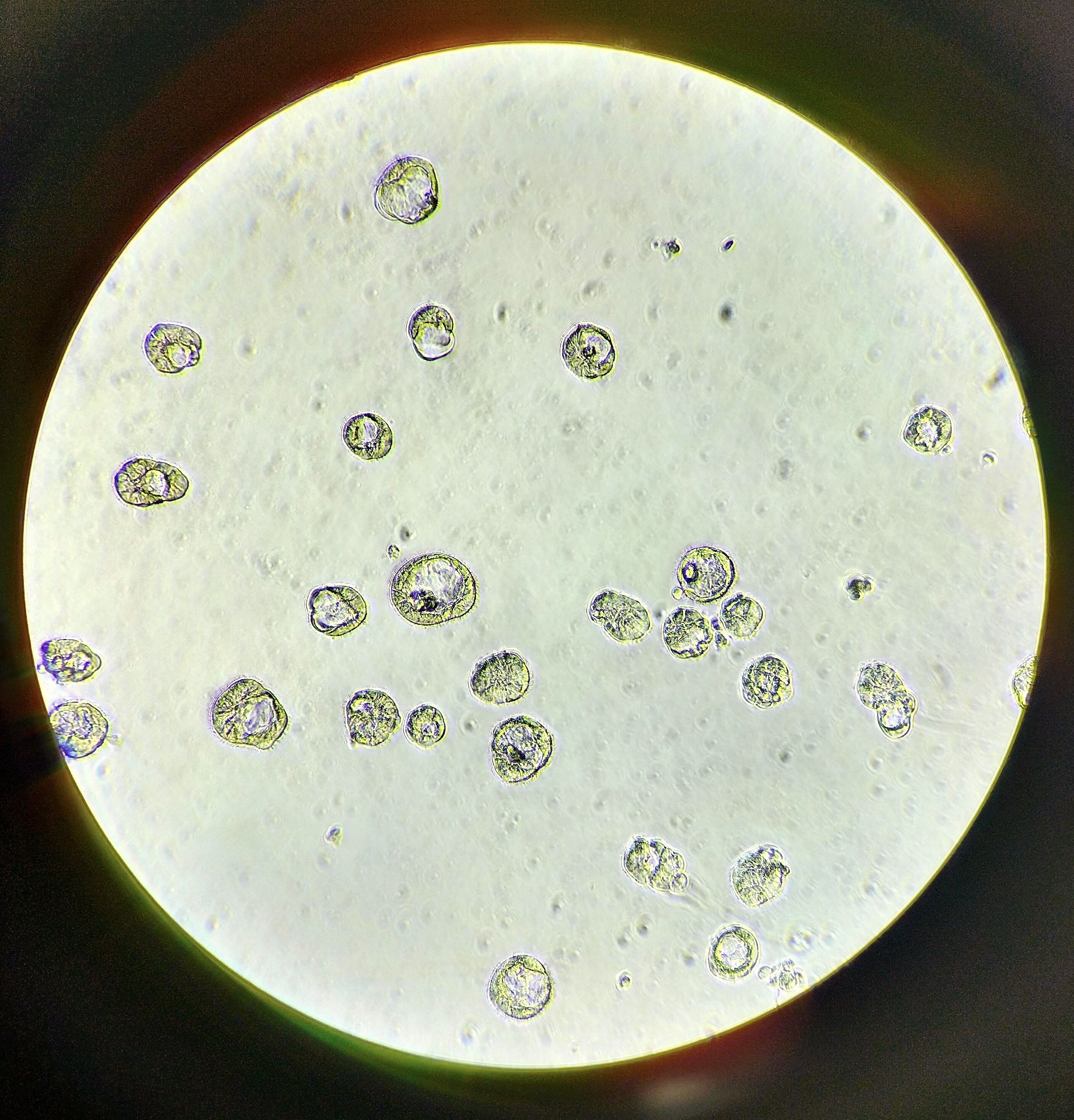 organoids