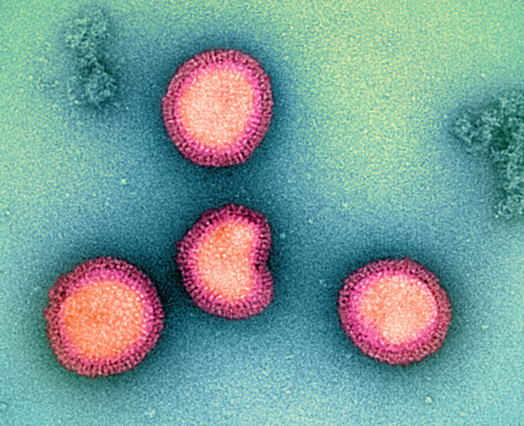 Influenza B 