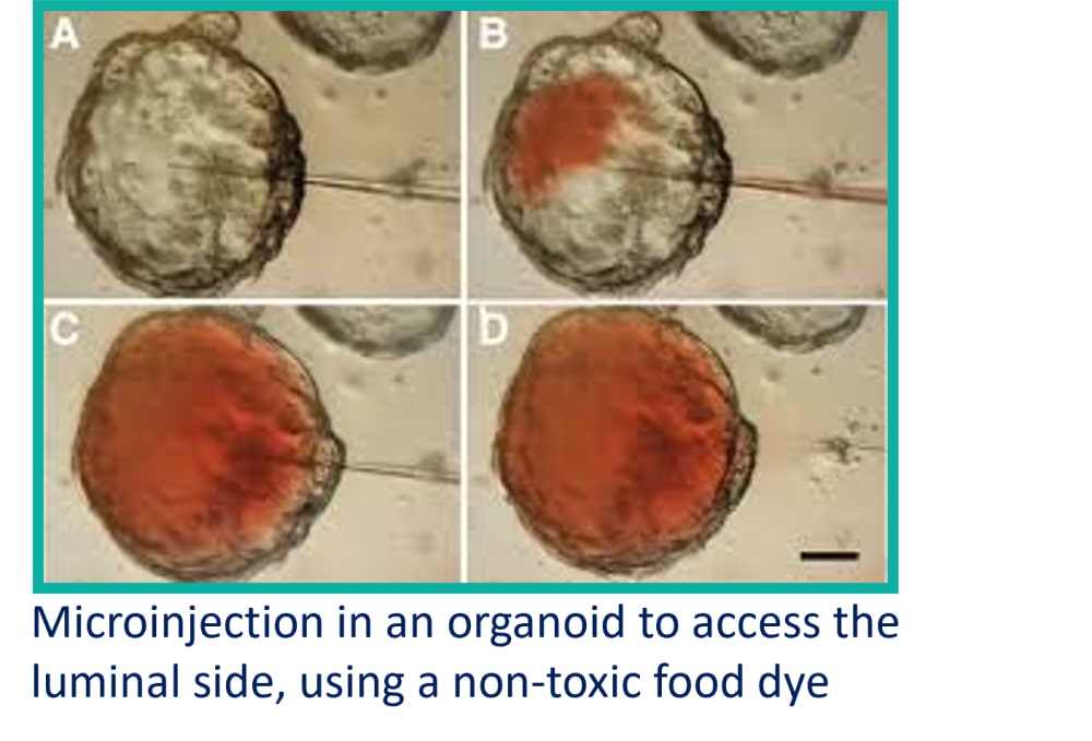 organoid